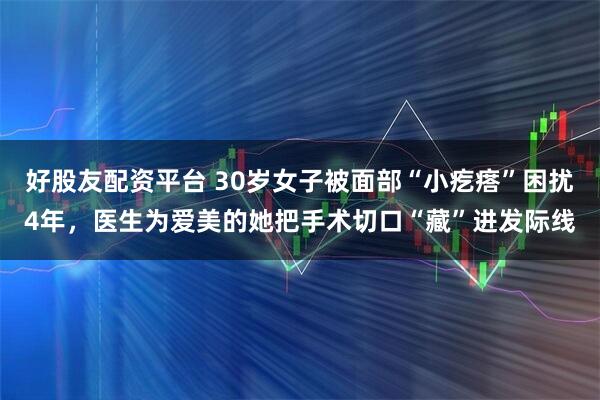 好股友配资平台 30岁女子被面部“小疙瘩”困扰4年，医生为爱美的她把手术切口“藏”进发际线